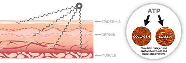 microcurrentfacial2medicineofcosmetics