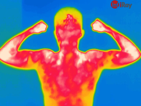 thermograph in medical