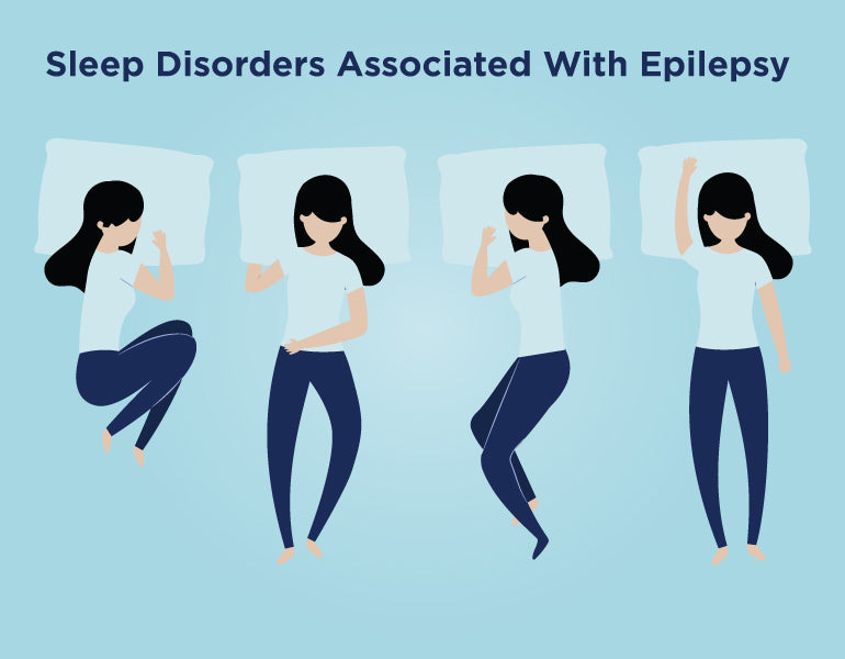 Sleep Disorders Associated With Epilepsy