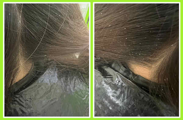 We will remove those unsightly nits from the hair.