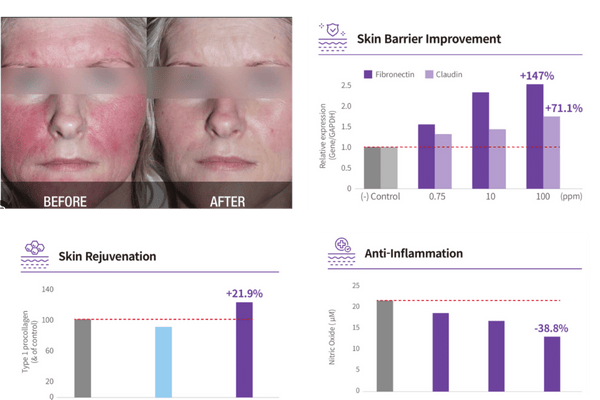 plant exosome redness solution skin proteomics