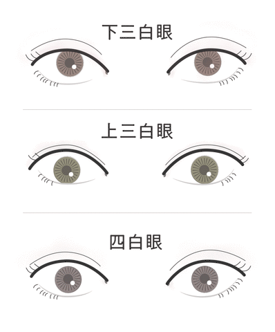三白眼の種類