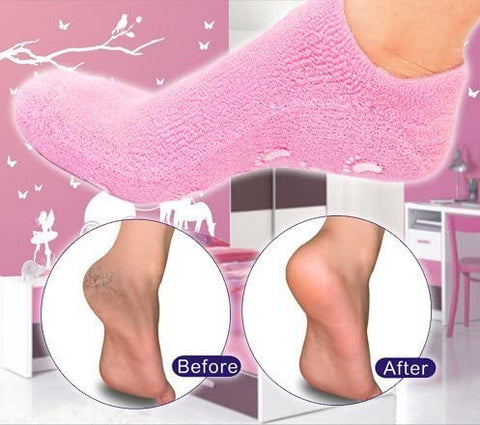 spa gel socks results