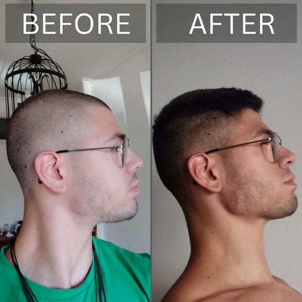 Does Chewing Gum Help Jawline? Before & After Chewing Falim Gum For a  Chiseled Jawline