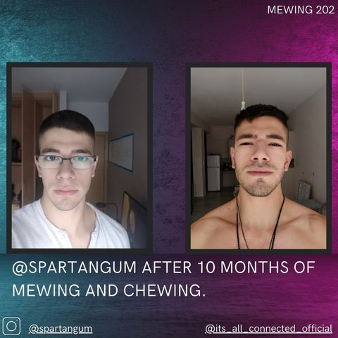 Mewing before and after