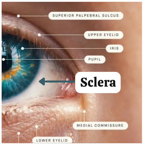 What  is sclera