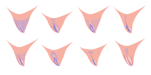 pelos vulva depilación vagina 