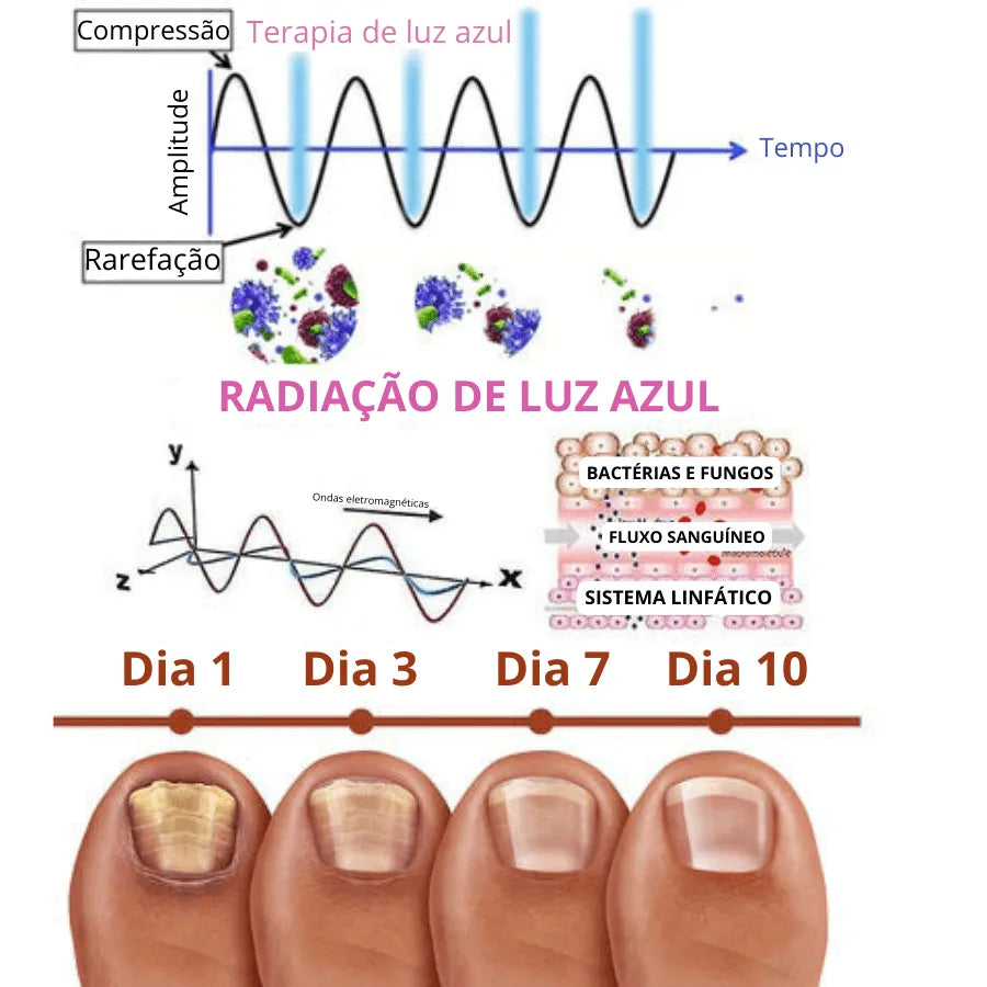 Nuvem Feet; Almofada terapêutica para pés; Conforto para salto alto; Sapatos confortáveis como nunca; Último dia na promoção; Pague 1 par, leve 3; Conforto para os pés; Almofada para sapatos; Redução de dores nos pés; Alívio para calos; Proteção para os pés; Almofada para salto alto; Conforto em cada passo; Alívio para pés cansados; Promoção imperdível; Almofada para calçados; Proteção para seus pés; Almofada de silicone; Conforto e proteção; Almofada para sapatos femininos; Alívio para dores nos pés; Almofada ortopédica; Almofada de gel; Conforto para o dia todo; Almofada para uso diário; Promoção exclusiva; Almofada para calçados confortáveis; Proteção para a planta do pé; Conforto para pés doloridos; Almofada ergonômica; Redução de impacto; Alívio para pés sensíveis; Promoção de almofadas; Almofada terapêutica de gel; Conforto para sapatos; Almofada para salto alto; Último dia de promoção; Almofada para conforto máximo; Redução de pressão nos pés; Almofada para conforto diário; Proteção para os pés; Almofada para sapatos apertados; Conforto instantâneo; Almofada de silicone para pés; Conforto para calçados; Alívio para pés doloridos; Almofada para pés femininos; Promoção de conforto; Almofada para pés saudáveis; Conforto para salto alto; Proteção e conforto para os pés; Almofada para sapatos elegantes; Alívio de dores e calos; Almofada terapêutica para salto alto; Promoção de conforto para pés; Almofada ortopédica para sapatos; Conforto para pés cansados; Almofada para sapatos femininos; Redução de dores nos pés; Almofada para calçados apertados; Conforto para sapatos de salto; Almofada de gel para pés; Conforto e alívio; Almofada para sapatos confortáveis; Promoção exclusiva de almofadas; Proteção para a planta do pé; Almofada ergonômica para pés; Alívio imediato; Almofada para pés sensíveis; Almofada de silicone para sapatos; Conforto em cada passo; Promoção de almofadas para pés; Almofada terapêutica para calçados; Conforto para sapatos de salto alto; Almofada para uso diário; Proteção para pés delicados; Almofada de gel para sapatos; Conforto para o dia todo; Almofada para pés femininos; Promoção imperdível; Conforto para pés cansados; Almofada ortopédica de gel; Alívio para dores nos pés; Almofada para calçados femininos; Proteção e conforto para pés; Almofada para sapatos elegantes; Alívio de dores e calos; Conforto para pés sensíveis; Almofada ergonômica; Conforto instantâneo; Almofada de silicone para calçados; Alívio imediato para pés; Almofada de gel para sapatos; Conforto para salto alto; Proteção para a planta do pé; Almofada para pés doloridos; Almofada de conforto para sapatos; Promoção de conforto para pés; Almofada ortopédica para sapatos; Almofada para calçados confortáveis; Proteção para pés sensíveis; Almofada ergonômica para sapatos; Alívio de pressão nos pés; Almofada para uso diário; Almofada de gel para conforto máximo; Proteção para pés cansados.     Gere uma série de pequenas frases e palavras, separadas por ponto e vírgula para serem utilizadas como texto alternativo das imagens da minha página de vendas para melhorar o SEO da minha página: https://inovetecstore.com.br/products/nail-fungus-laser-treatment-device-repair-toenail-fingernail-fungus-treat-onychomycosis-laser-nails-with-mushrooms-relaxation ChatGPT Claro, aqui estão algumas sugestões de texto alternativo para as imagens da sua página de vendas:  Tratamento a laser para fungos nas unhas; Dispositivo para tratamento de fungos nas unhas; Trate fungos nas unhas; Tratamento eficaz para onicomicose; Laser para unhas com fungos; Tecnologia avançada para unhas saudáveis; Remédio para unhas afetadas por fungos; Tratamento inovador para fungos em unhas dos pés e mãos; Dispositivo a laser para unhas; Solução para unhas danificadas por fungos; Tratamento a laser para onicomicose; Terapia a laser para fungos nas unhas; Trate fungos nas unhas com laser; Dispositivo de tratamento para onicomicose; Tratamento seguro para fungos nas unhas; Solução eficaz para unhas afetadas por fungos; Tecnologia de laser para unhas saudáveis; Tratamento natural para fungos nas unhas; Redução de fungos nas unhas com laser; Tratamento de unhas infectadas por fungos; Laser para unhas danificadas por fungos; Tratamento não invasivo para fungos em unhas; Terapia a laser para unhas danificadas; Dispositivo para tratamento de fungos em unhas dos pés; Tratamento a laser para unhas saudáveis; Solução para unhas afetadas por fungos nas mãos e pés; Tratamento inovador para fungos nas unhas; Dispositivo a laser para unhas saudáveis; Tratamento eficaz para fungos nas unhas dos pés e mãos; Terapia a laser para onicomicose; Redução de fungos nas unhas com laser; Tecnologia de laser para unhas saudáveis; Tratamento seguro para onicomicose; Solução eficaz para unhas danificadas por fungos; Tratamento natural para unhas infectadas por fungos; Terapia a laser para unhas afetadas por fungos; Dispositivo para tratamento de unhas danificadas; Tratamento a laser para onicomicose; Trate fungos nas unhas com laser; Tecnologia avançada para unhas saudáveis; Solução para unhas afetadas por fungos nas mãos e pés; Tratamento inovador para unhas infectadas por fungos; Dispositivo a laser para fungos nas unhas; Terapia a laser para unhas afetadas; Tratamento seguro para unhas danificadas por fungos; Tratamento natural para fungos nas unhas; Redução de fungos nas unhas com laser; Laser para unhas saudáveis; Tratamento de unhas infectadas por fungos; Dispositivo a laser para unhas danificadas; Solução para fungos nas unhas dos pés e mãos; Tratamento a laser para onicomicose; Tecnologia avançada para unhas saudáveis.