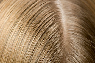 close up image of a woman's scalp