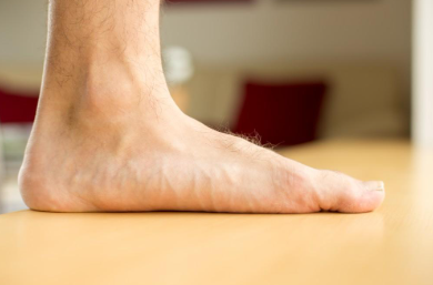 Flat Feet-Flatfoot Correction-Flat Foot