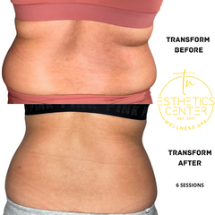 Before and after EvolveX Transform Muscle Toning services which shows fat and low muscle definition on lower back and better muscle tone and less fat after treatment on lower back