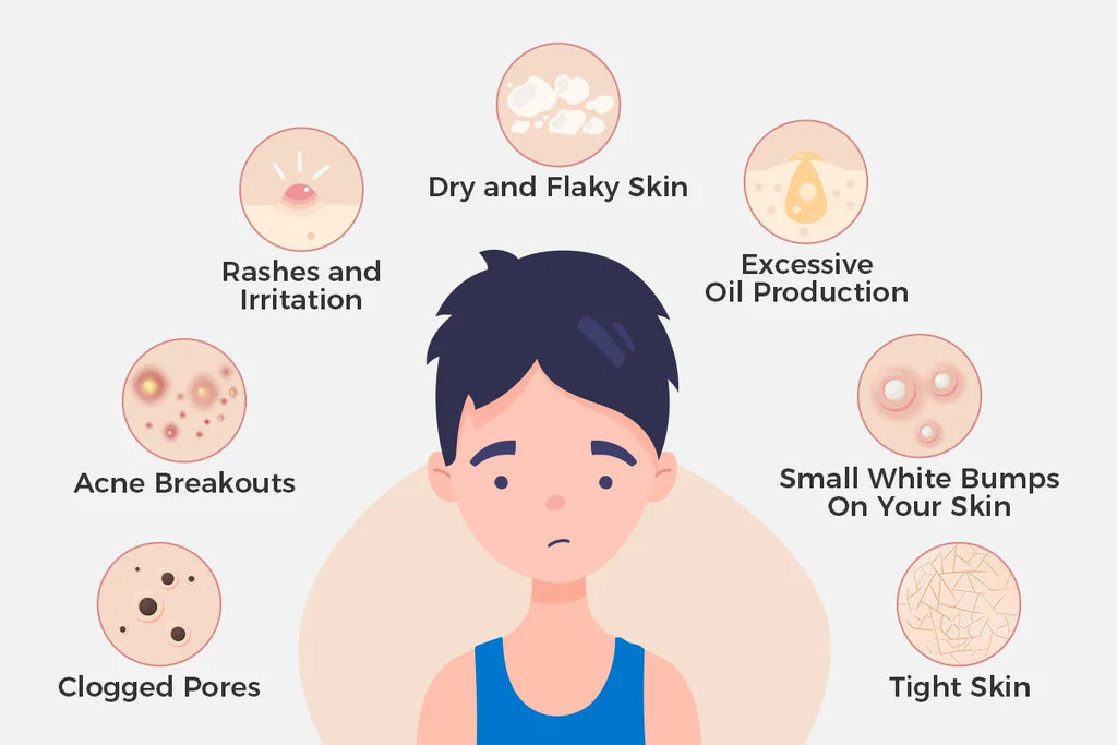 Signs You Are Over-Moisturizing