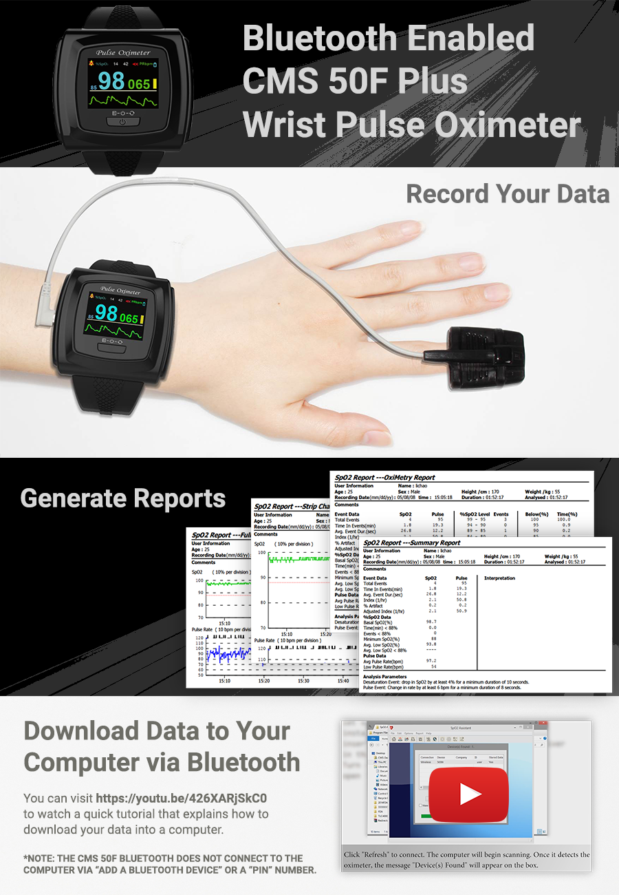 CMS 50F Plus Wrist Oximeter. Record data, generate reports, download data.