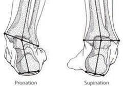 Graphic depicting anatomy of the ankle joint and foot when you Pronate or Supinate