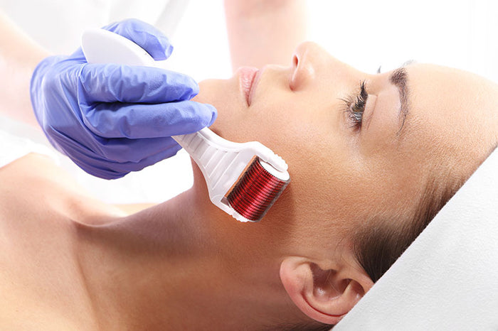 micro-needling-treatment-in-hollywood