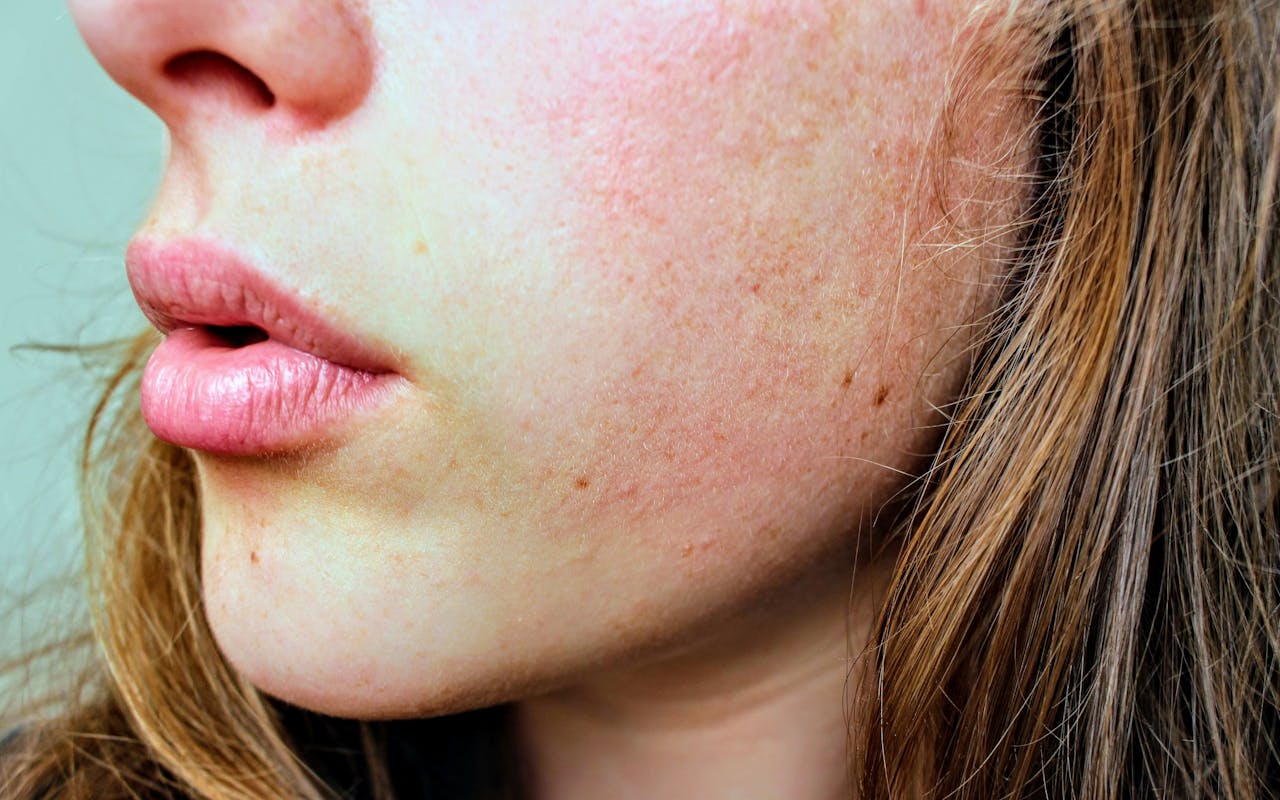 close up of woman’s red cheek