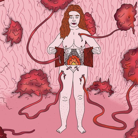 Venus Libido: Fire Sickness - how endometriosis feels