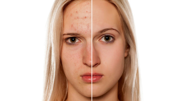 beauty and health does tech make us look good but feel bad before and after