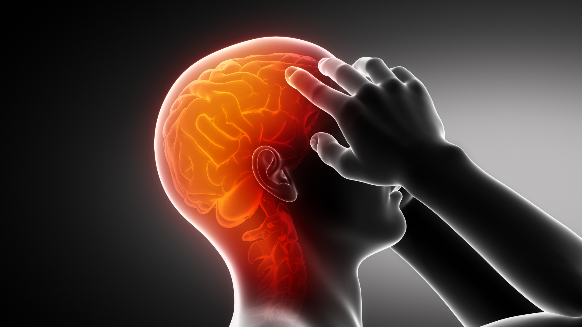 Can CBD Help with Migraines? CBD for Migraine 