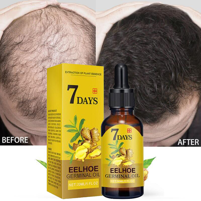 Eelhoe 7 Days Ginger Hair Restorer Essential Oil