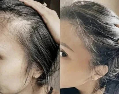 Close-up of a woman's head showing hair thinning and regrowth.