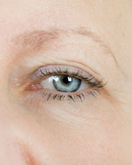 woman with droopy eyelids