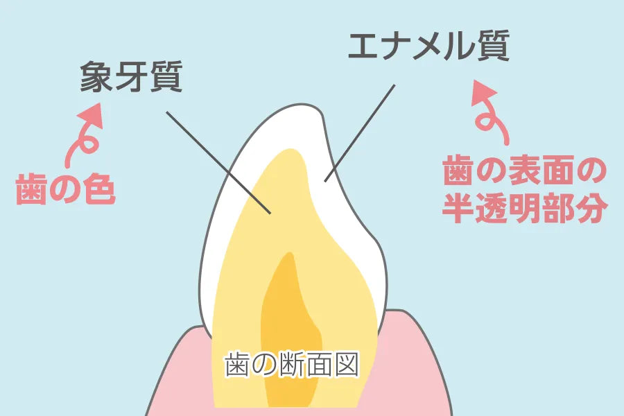 磨いても白くならない歯があるんです！