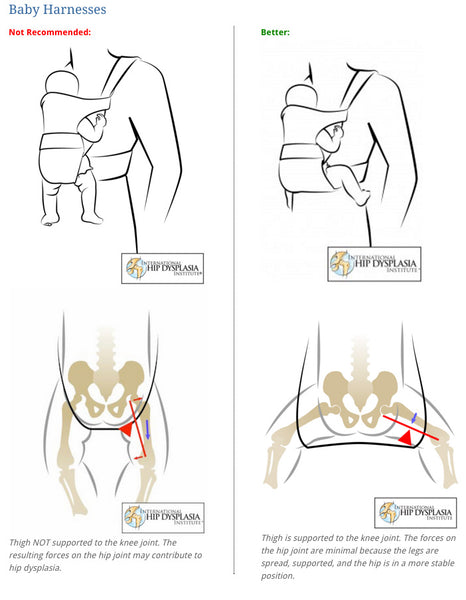 infographic on optimal hip positioning in a sling