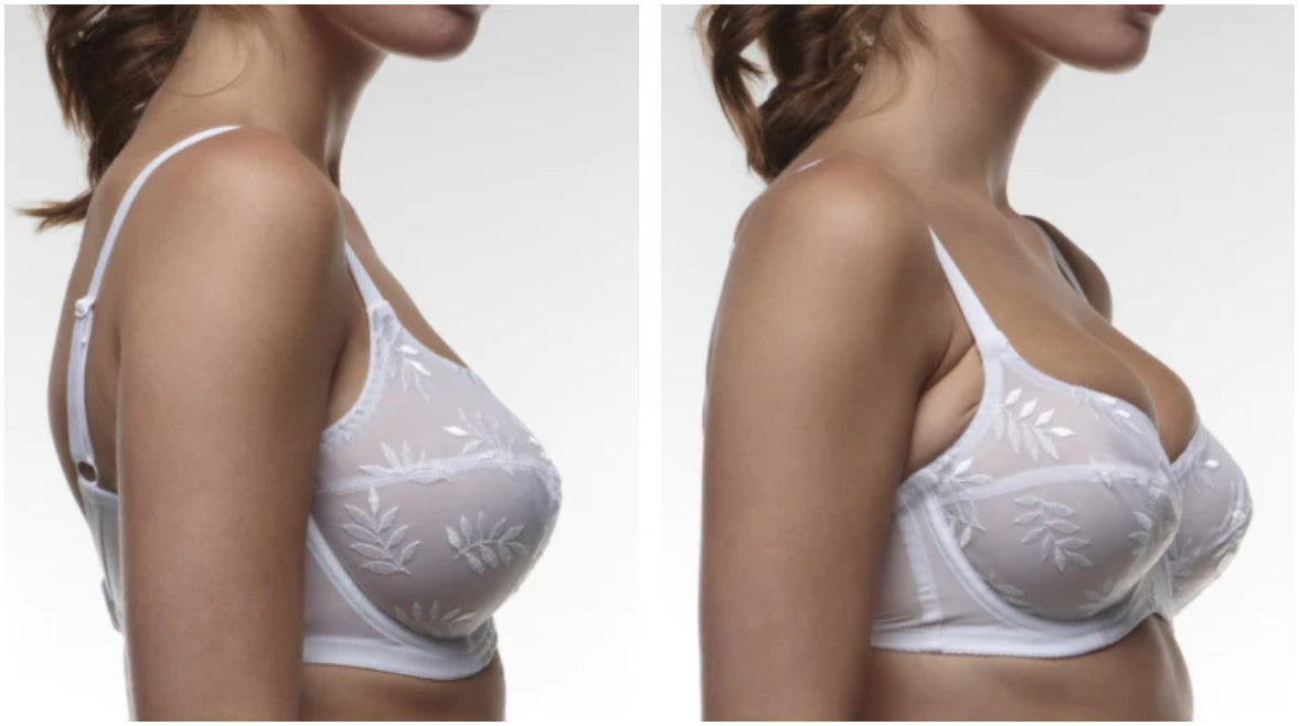 Ill Fitted Bra Example