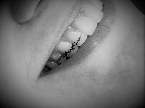 Multi tooth Temporary Tattooth. Smiling!