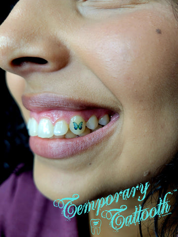 A close up of a girl with a butterfly temporary tooth tattoo.  These Temporary Tattoos can be applied professionally or at home, and can be removed at anytime.