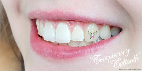 A photo of a butterfly or tooth fairy Temporary Tattooth, or tooth tattoo.