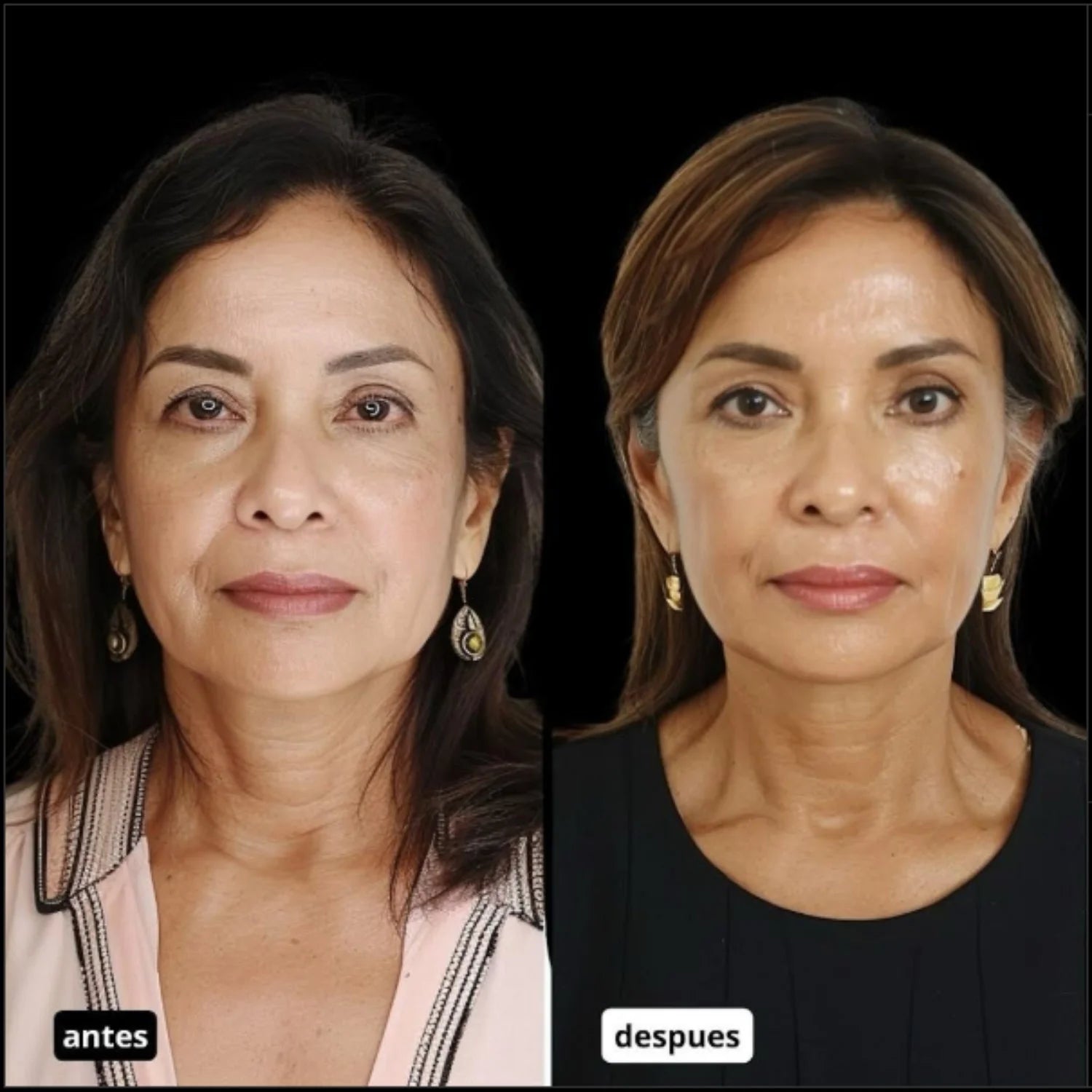 Antes y después 3
