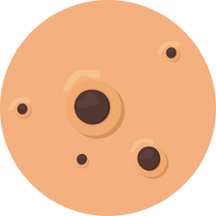 Blackhead illustration