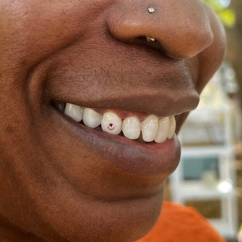 Tooth gem