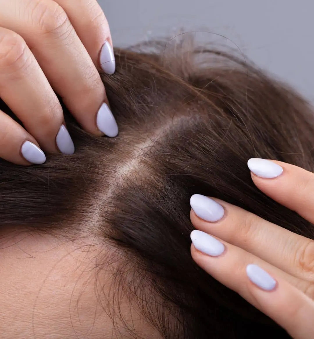 Close up shot of woman's scalp