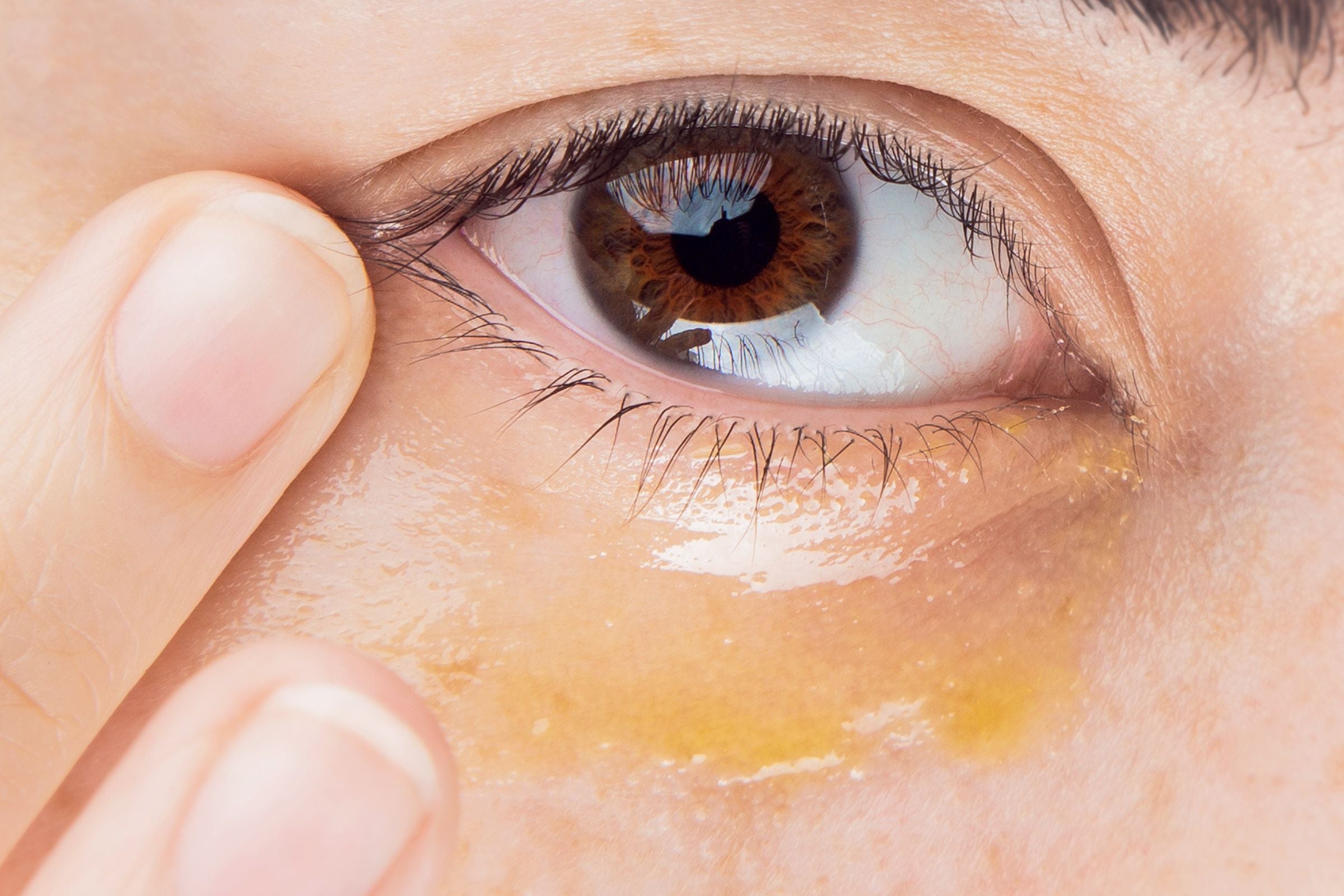 How to Get Rid of Bags Under Eyes Fast | Women's Health