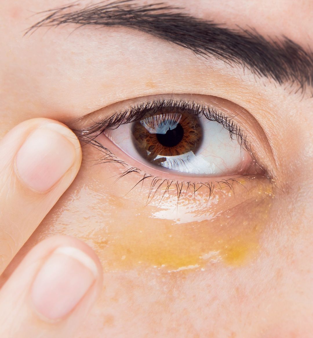 Is Eye Cream Really Necessary? Let's Find Out Once and For All – 100% PURE