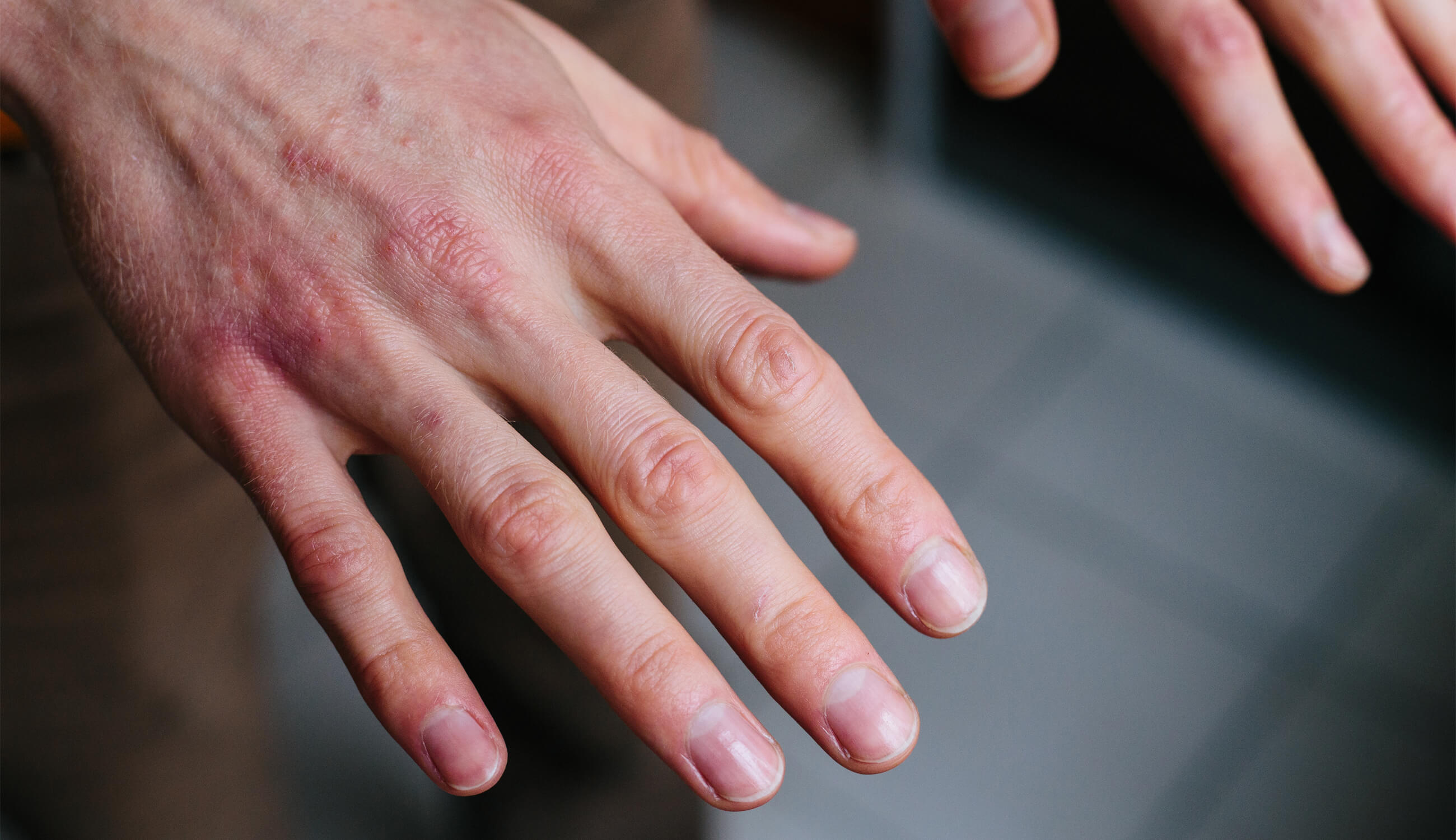 Drying hands, an indispensable step in hand hygiene