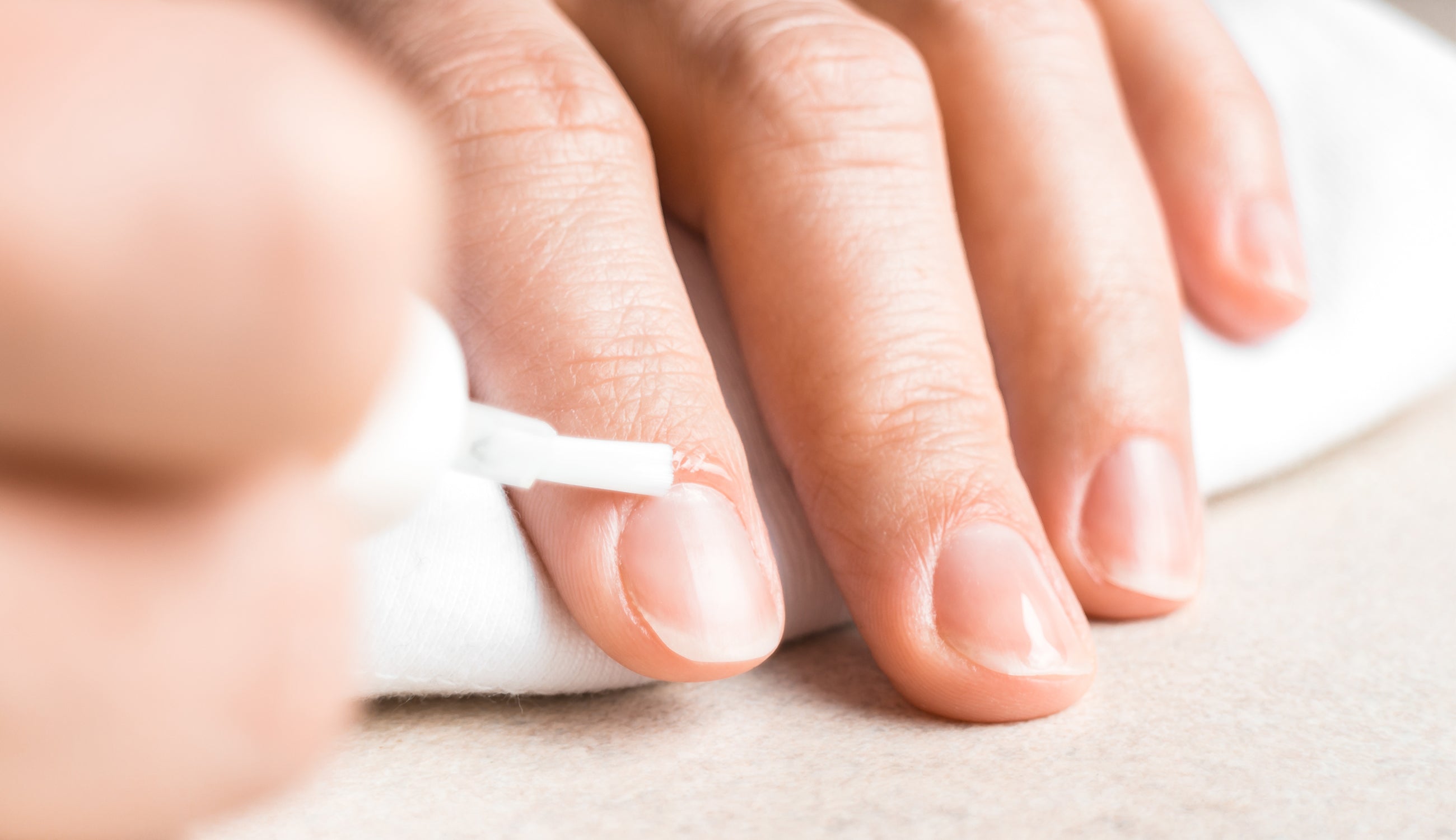 Top 10 Things Your Nails Say About Your Health | HowStuffWorks