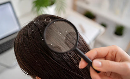 Magnifying glass for dandruff hair