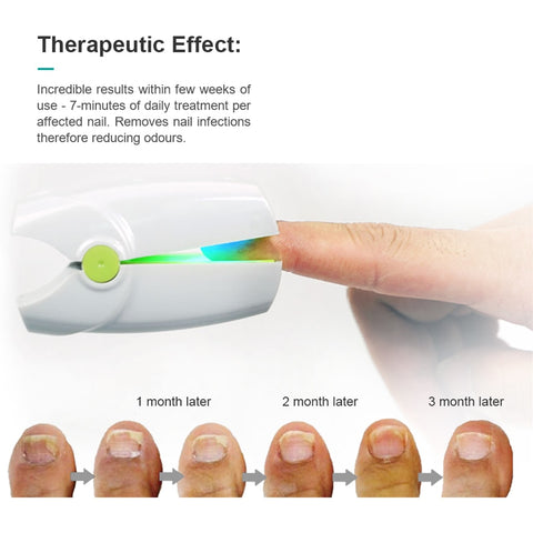 Nail treatment device, home & clinic, equipment India | Ubuy