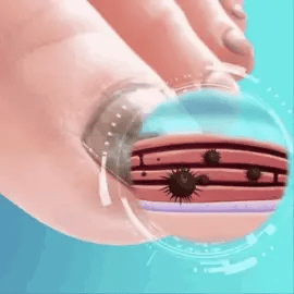 Crema Anti-Hongos Aichun Beauty - Producto principal