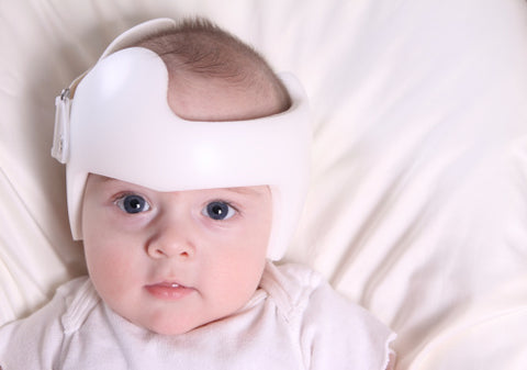 Why Babies Wear Helmets