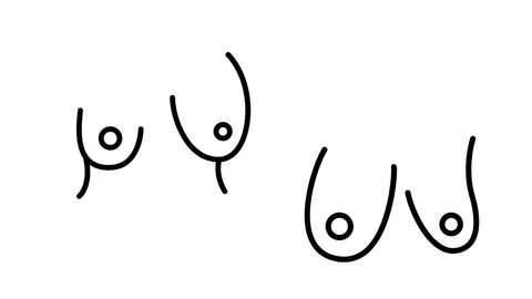 illustration of asymmetrical breasts