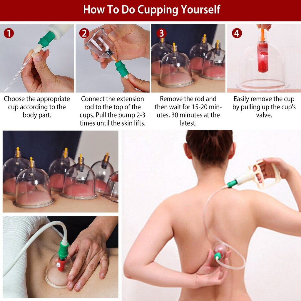 Cupping Therapy Set