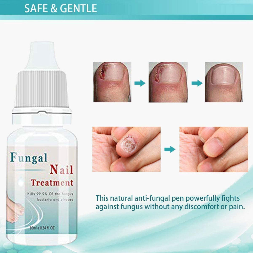 Best Fungal Nail Treatment UK