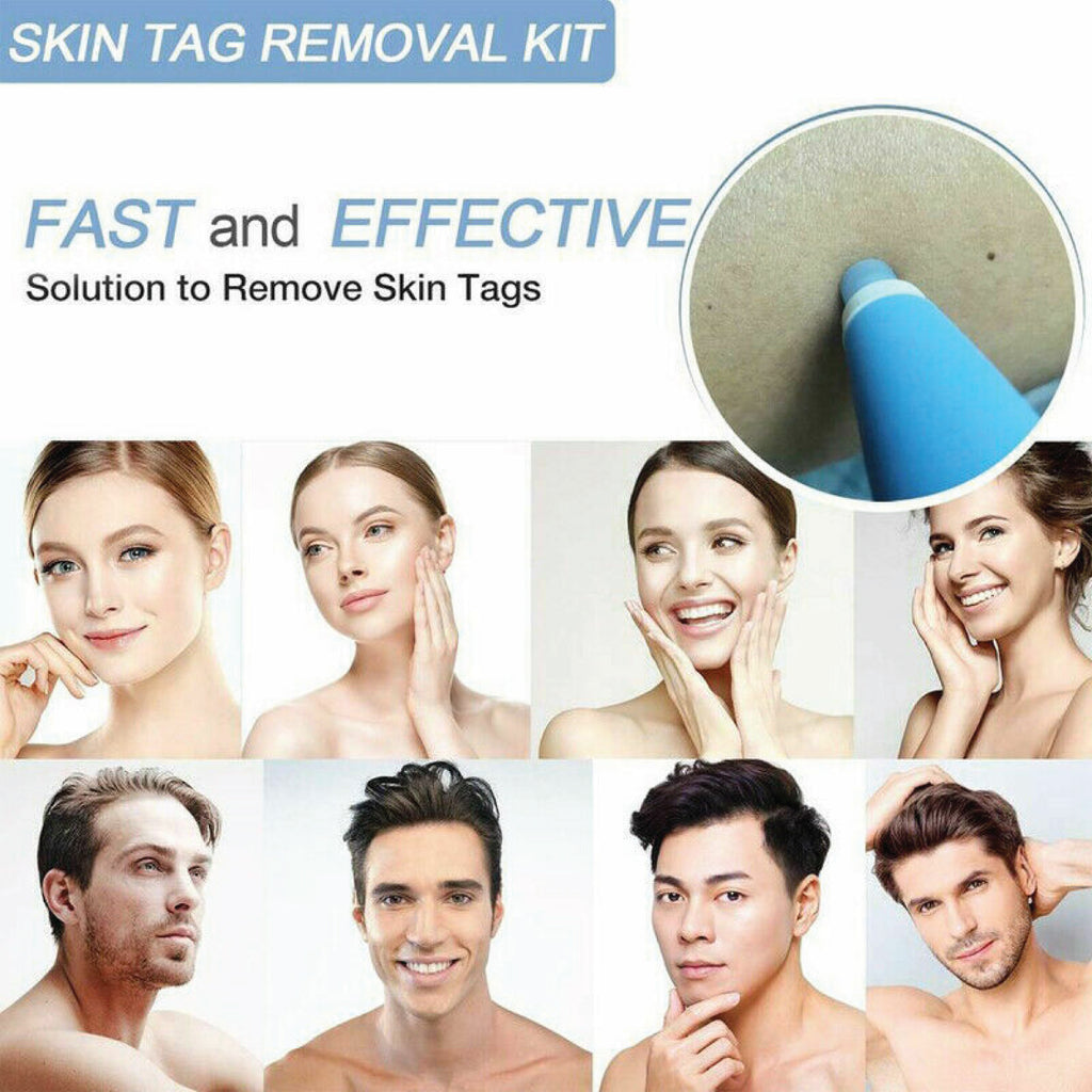 Sking Tag Remover