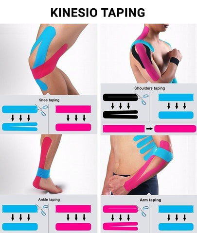 Does Kinesiology Tape Work