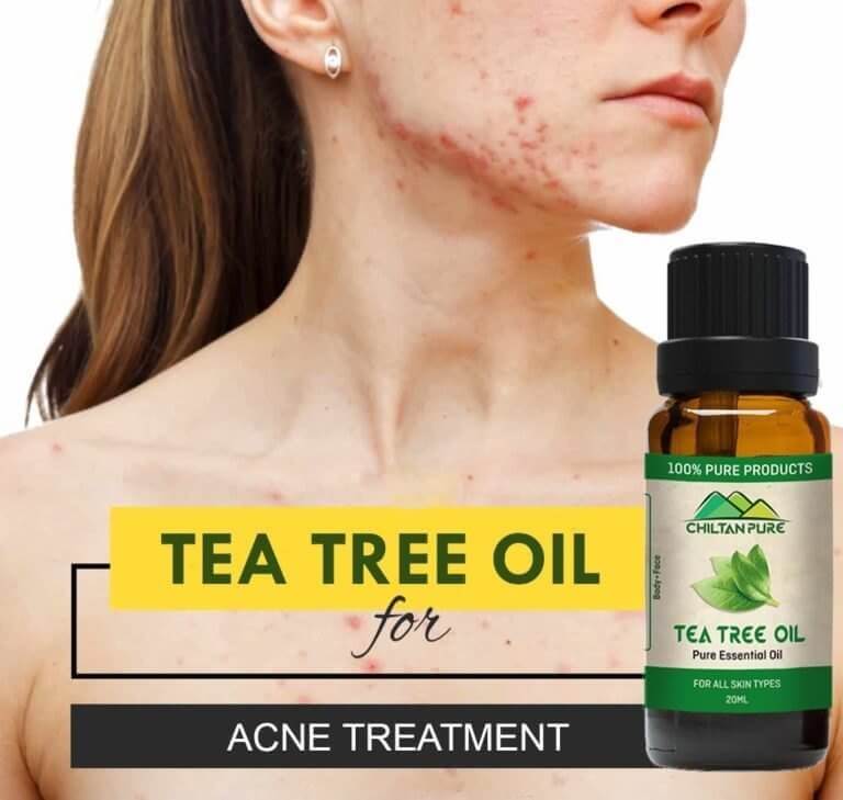 Tea Tree Oil Uses: Benefits for Skin & Hair – ChiltanPure